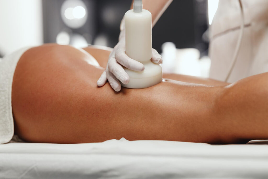Accent Prime Treatment