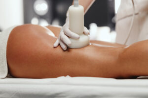 Accent Prime Treatment