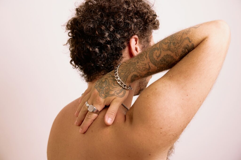tattoo removal