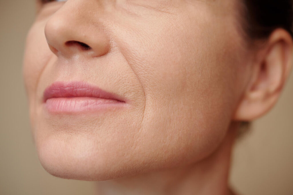 facial wrinkles