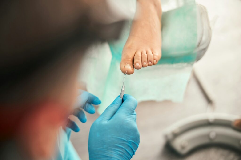 Nail Treatment