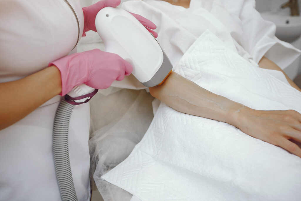 laser hair removal