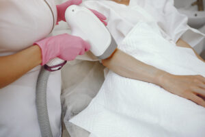laser hair removal