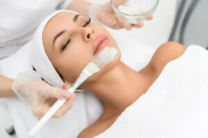 Chemical Peel