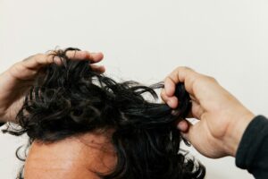 Hair Restoration